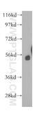 Calcium-dependent secretion activator 2 antibody, 11924-1-AP, Proteintech Group, Western Blot image 