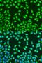 Mitochondrially Encoded Cytochrome C Oxidase II antibody, LS-C746894, Lifespan Biosciences, Immunofluorescence image 