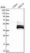 Ring Finger Protein 115 antibody, HPA019130, Atlas Antibodies, Western Blot image 