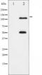 Nuclear Factor Kappa B Subunit 1 antibody, TA325716, Origene, Western Blot image 