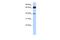 Zinc Finger Protein 879 antibody, A17657, Boster Biological Technology, Western Blot image 