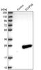 Dual Specificity Phosphatase 26 antibody, NBP2-33880, Novus Biologicals, Western Blot image 