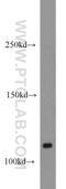 CYLD Lysine 63 Deubiquitinase antibody, 11110-1-AP, Proteintech Group, Western Blot image 