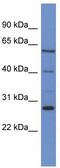 Cytochrome P450 Family 24 Subfamily A Member 1 antibody, TA342861, Origene, Western Blot image 