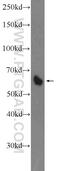 V-Set Domain Containing T Cell Activation Inhibitor 1 antibody, 12080-1-AP, Proteintech Group, Western Blot image 