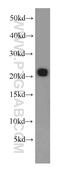 Ras-related protein Rab-31 antibody, 16182-1-AP, Proteintech Group, Western Blot image 