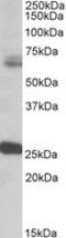 Glutamate Decarboxylase 2 antibody, MBS420397, MyBioSource, Western Blot image 