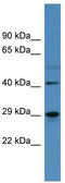 Carbonic anhydrase 2 antibody, TA342839, Origene, Western Blot image 