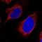 Chromosome 12 Open Reading Frame 29 antibody, NBP1-84177, Novus Biologicals, Immunocytochemistry image 