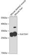 DHEA-ST antibody, GTX54718, GeneTex, Western Blot image 