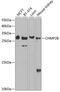 Charged Multivesicular Body Protein 2B antibody, 14-974, ProSci, Western Blot image 