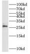 Nuclear Receptor Interacting Protein 3 antibody, FNab05858, FineTest, Western Blot image 