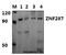Zinc Finger Protein 287 antibody, A17720-1, Boster Biological Technology, Western Blot image 