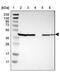 Uroplakin 3B antibody, PA5-52696, Invitrogen Antibodies, Western Blot image 