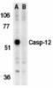Caspase-12 antibody, TA306053, Origene, Western Blot image 