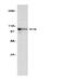 Nucleolin antibody, MA1-25778, Invitrogen Antibodies, Western Blot image 