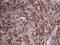Diacylglycerol Kinase Zeta antibody, M06678, Boster Biological Technology, Immunohistochemistry paraffin image 