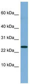 NBL1, DAN Family BMP Antagonist antibody, TA342244, Origene, Western Blot image 