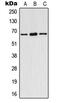 Estrogen Receptor 1 antibody, MBS822018, MyBioSource, Western Blot image 
