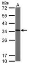 Metabolism Of Cobalamin Associated C antibody, LS-C185841, Lifespan Biosciences, Western Blot image 