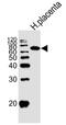 Intestinal-type alkaline phosphatase antibody, MBS9201729, MyBioSource, Western Blot image 