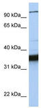 Kinesin-like protein KIFC3 antibody, TA334692, Origene, Western Blot image 