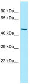 Killer Cell Immunoglobulin Like Receptor, Three Ig Domains And Long Cytoplasmic Tail 2 antibody, TA343357, Origene, Western Blot image 