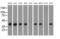 3-Hydroxyisobutyryl-CoA Hydrolase antibody, MA5-25150, Invitrogen Antibodies, Western Blot image 