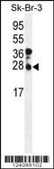 Charged Multivesicular Body Protein 4B antibody, MBS9214544, MyBioSource, Western Blot image 