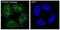 S100 Calcium Binding Protein A4 antibody, M01217-1, Boster Biological Technology, Immunofluorescence image 