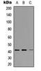 NDRG Family Member 2 antibody, MBS8207067, MyBioSource, Western Blot image 