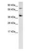 Sp7 Transcription Factor antibody, PA1-30865, Invitrogen Antibodies, Western Blot image 