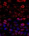 Fibroblast growth factor receptor 2 antibody, LS-C747539, Lifespan Biosciences, Immunofluorescence image 