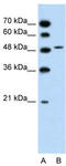 Sodium/bile acid cotransporter 5 antibody, TA334146, Origene, Western Blot image 