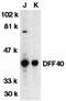 DNA Fragmentation Factor Subunit Beta antibody, GTX31262, GeneTex, Western Blot image 