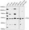 Pentraxin 3 antibody, GTX64405, GeneTex, Western Blot image 