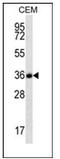 Follistatin-related protein 3 antibody, AP51732PU-N, Origene, Western Blot image 
