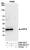 NOP16 Nucleolar Protein antibody, A305-124A, Bethyl Labs, Immunoprecipitation image 