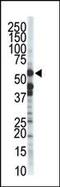 Zinc Metallopeptidase STE24 antibody, PA5-12161, Invitrogen Antibodies, Western Blot image 