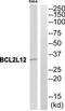 BCL2 Like 12 antibody, TA313206, Origene, Western Blot image 