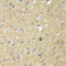 Aldo-Keto Reductase Family 7 Member A2 antibody, LS-C331369, Lifespan Biosciences, Immunohistochemistry frozen image 