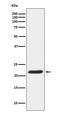 Tumor Protein, Translationally-Controlled 1 antibody, M03414, Boster Biological Technology, Western Blot image 