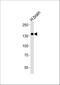 NT-3 growth factor receptor antibody, M02502-1, Boster Biological Technology, Western Blot image 