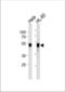 Serine/threonine-protein kinase 51PK antibody, TA325175, Origene, Western Blot image 