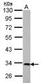 3-hydroxyisobutyrate dehydrogenase, mitochondrial antibody, NBP2-16827, Novus Biologicals, Western Blot image 