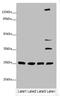 Lin-7 Homolog A, Crumbs Cell Polarity Complex Component antibody, orb24849, Biorbyt, Western Blot image 