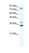 Zinc Finger Protein 570 antibody, NBP1-80143, Novus Biologicals, Western Blot image 