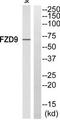 Frizzled Class Receptor 9 antibody, TA314731, Origene, Western Blot image 