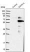 Protein DGCR14 antibody, PA5-51542, Invitrogen Antibodies, Western Blot image 