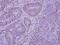 Histone Deacetylase 7 antibody, PA5-29937, Invitrogen Antibodies, Immunohistochemistry frozen image 